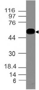 Monoclonal Antibody to Ebola GP I (Clone: ABM47F9)