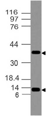 Monoclonal antibody to S100A7/Psoriasin (Clone: ABM18A5)