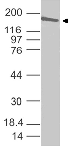 Coronavirus (COVID-19) Spike Antibody (Clone: ABM19C9) Coronavirus (COVID-19) Spike Antibody (Clone: ABM19C9)