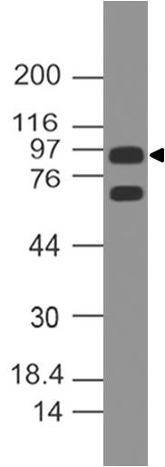 Monoclonal Antibody to Androgen receptor (Clone: ABM20C2)