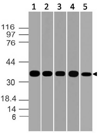 Figure-7: Western blot analysis of GAPDH. Anti- GAPDH antibody (Clone: ABM22C5) was used at 1 µg/ml on (1) h Brain, (2) m Brain, (3) h Pancrease, (4) h Kidney and (5) m Skeletal Muscle lysates.