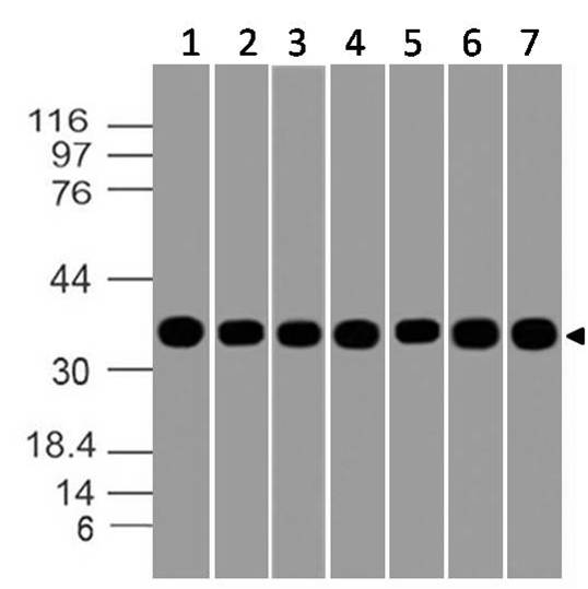 Monoclonal Antibody to GAPDH (Clone: ABM22C5)