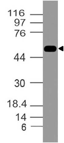 Fig.2: Expression analysis of DR-4. Anti-DR4 antibody (Clone: ABM1B11) was tested at 2 µg/ml on K562 lysate.