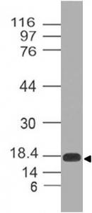 Monoclonal Antibody to Ebola GP II (Clone: ABM4C78)