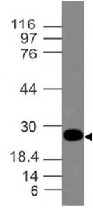 Monoclonal Antibody to MERS-CoV Spike (S) protein (Clone: ABM4A80)