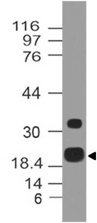 Monoclonal Antibody to ZIKA E protein (Clone: ABM5A43)