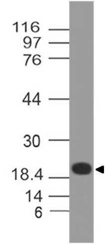 Monoclonal Antibody to ZIKA Envelope protein (Clone: ABM54D4)