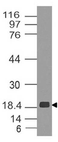 Monoclonal Antibody to ZIKA NS5  (Clone: ABM5G47)