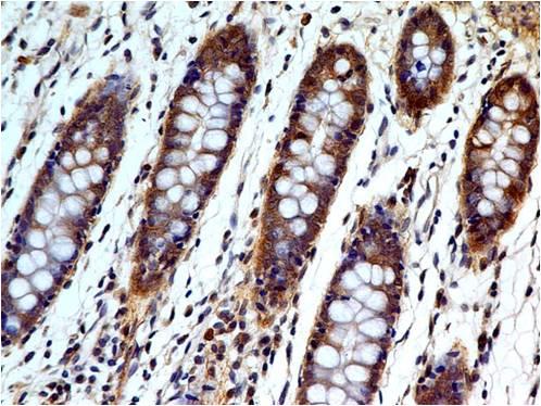 Monoclonal Antibody to Caspase-3 (Pro and Active) (Clone: ABM1C12)