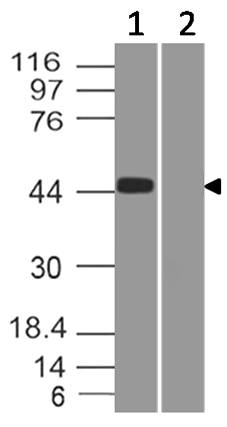 Figure-1: Western Blot analysis of SARS CoV2 Spike RBD Antibody: Anti- SARS CoV2 Spike RBD Antibody (Clone: ABM6G1.1A2) was used at 5 µg/ml on (1) SARS-CoV-2 virus infected Vero Cell lysates and (2) Mock infected lysates.