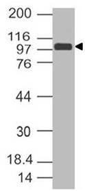 SARS CoV2 Spike S1 Antibody (Clone: ABM3D6.1G6) (13-33aa)