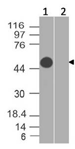 Monoclonal Antibody to SARS-CoV-2 nucleocapsid (Clone: ABM2D6.2C2)