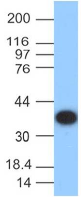 Protein A Monoclonal Antibody (Clone: ABM2A4.1E3)