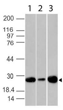 Monoclonal Antibody to Bcl-2 (Clone: BC1)