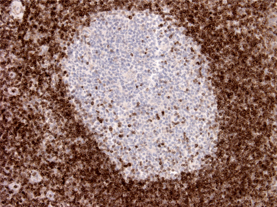 Mouse Monoclonal Antibody to Bcl2(Clone :BS94)