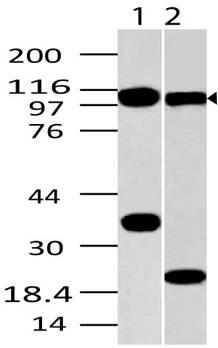 Monoclonal Antibody to TLR9 (Clone: ABM1C51) Monoclonal Antibody to TLR9 (Clone: ABM1C51)