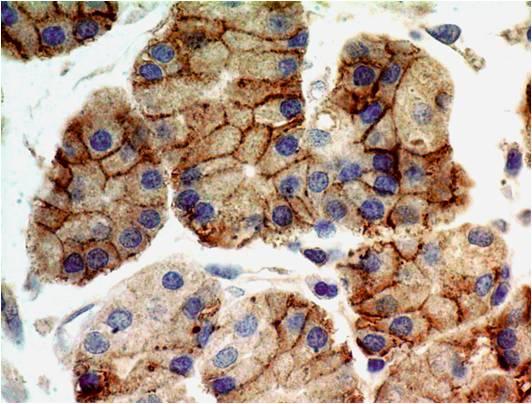 Monoclonal Antibody to TLR9 (Clone: ABM1C51)