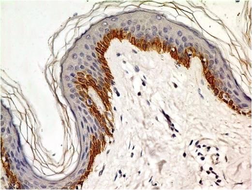 Monoclonal Antibody to TLR4 / CD284 (Clone: ABM19C4)