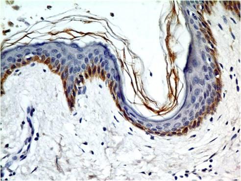 NALE™ Monoclonal Antibody to TLR5 (Clone: ABM22G1)