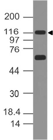 Monoclonal Antibody to TLR2 (Clone: ABM3A87)