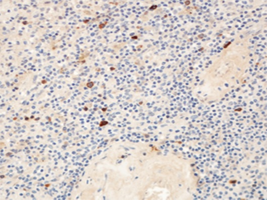 Monoclonal Antibody to Human CD180 (Clone-MHR73)