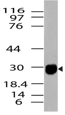 Monoclonal Antibody to HMGB1 (Clone: ABM2E44)