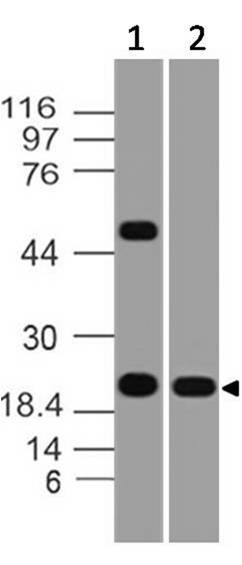 Figure-4: Western blot analysis of CD69. Anti- CD69 antibody (Clone: ABM39A4) was used at 4 µg/ml on (1)Daudi and (2) h Lung lysates.
