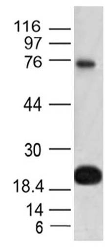 Monoclonal Antibody to CD69 (Clone: ABM39A4) BSA Free