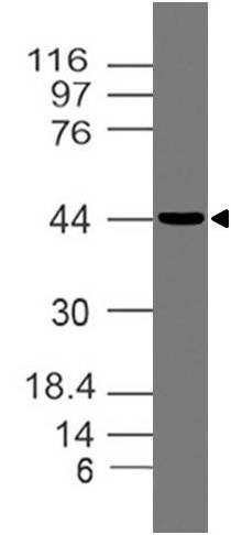 Monoclonal Antibody to OPG (Clone: ABM10D2 )