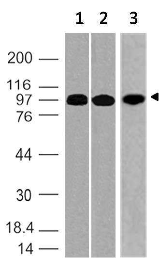 Monoclonal Antibody to RANK (CD265, TNF11aR, ODFR) (Clone: ABM10D5)