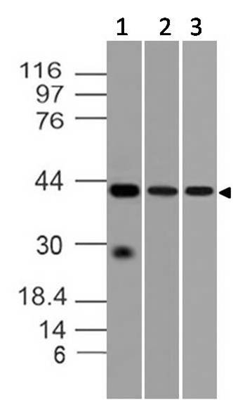 Monoclonal Antibody to DFF-40 (Clone: ABM1H15)