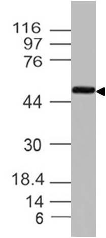 Monoclonal Antibody to Ikk Gamma (Clone: ABM15D9)