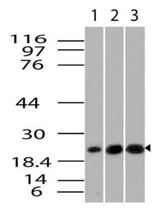 Monoclonal Antibody to kB-Ras1 (Clone: ABM17B5)