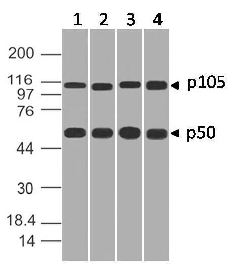 Monoclonal Antibody to p105/p50 (Clone: ABM20H5)