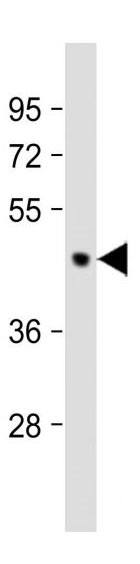 Mouse Monoclonal Antibody to PDK2 (Clone: 180CT10.2.3)(Discontinued)