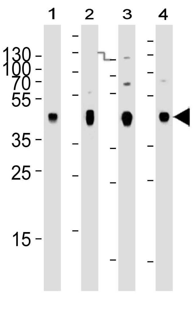 Figure 4:  Western blot analysis of PDK2 antibody (10-6544) with lane 1: human skeletal muscle, lane 2: human brain, lane 3: mouse brain, lane 4: rat brain tissue. PDK2 antibody was diluted at 1:2000 at each lane. A goat anti-mouse IgG H&L (HRP) at 1:3000 dilution was used as the secondary antibody. Lysates at 20μg per lane.