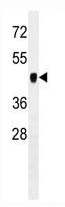 Mouse Monoclonal Antibody to PDK2 (Clone: 180CT10.2.3)(Discontinued)