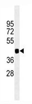 Mouse Monoclonal Antibody to PAX6 (Clone: 193CT15.2.2)(Discontinued)