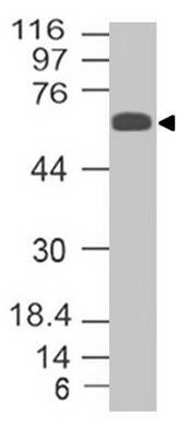 Monoclonal Antibody to Trim29 (Clone: ABM43D2) Monoclonal Antibody to Trim29 (Clone: ABM43D2)