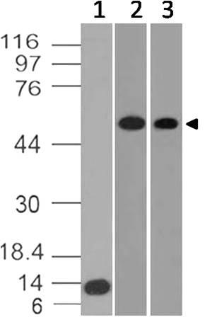 Monoclonal Antibody to Glut-1 (Clone: ABM4G40)