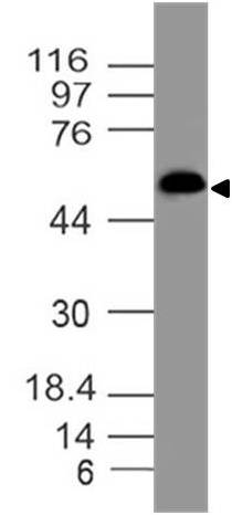 Monoclonal antibody to GluT1 (Clone: ABM51E4)