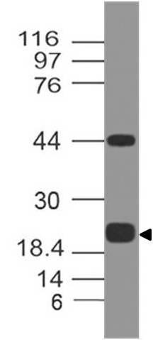 Monoclonal antibody to Human PD-L1 (Clone: ABM5F25)