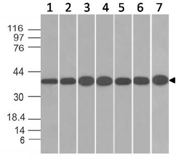 Monoclonal antibody to  Annexin I (Clone: ABM58D1)