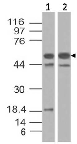 Anti Glut-4 Monoclonal Antibody (Clone: ABM5D66)