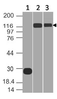 Anti-ACE2 Monoclonal antibody (Clone: ABM1H3.1G11)