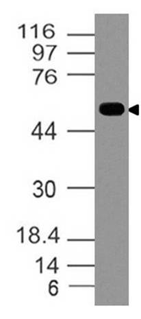 Polyclonal Antibody to Wnt5a