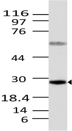 Polyclonal Antibody to Caspase-12