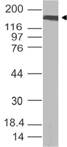 Coronavirus (COVID-19) Spike Antibody Coronavirus (COVID-19) Spike Antibody