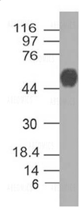 Figure-2: Western Blot analysis of Nucleocapsid antibody (SARS-CoV-2): Anti- Nucleocapsid antibody (SARS-CoV-2) cat no.11-2004B was used at 1 µg/ml on recombinant Nucleocapsid Protein (Cat#21-1003).