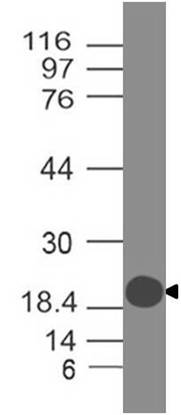 Polyclonal ACE2 antibody